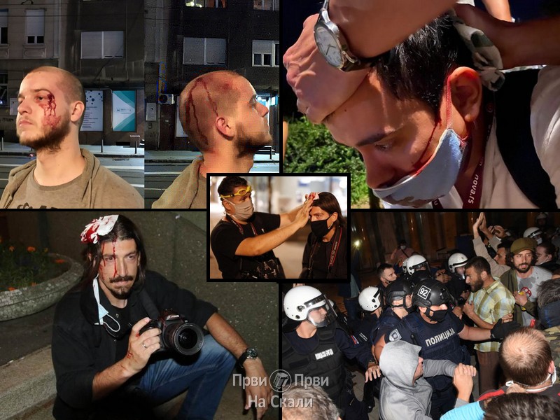 Radna grupa, koju je inicirao Zaštitnik građana, osudila brutalne napade na novinare