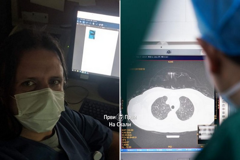 Pulmolog Srđan Lukić: Šta se dešava kod upale pluća?