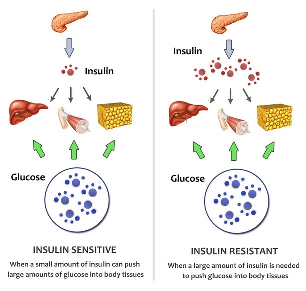 Preslišavanje o dijabetesu i insulinskoj rezistenciji